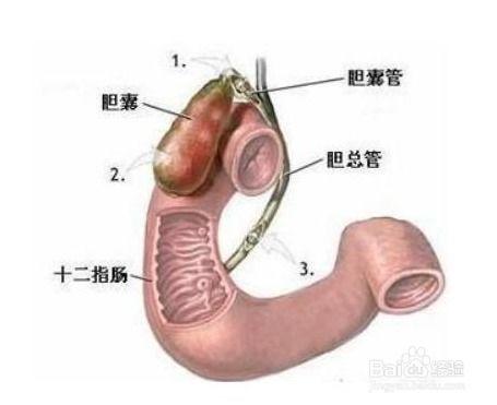 胆囊炎可以吃小乳瓜吗,胆囊炎患者可适量食用小乳瓜