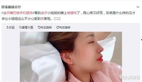 吃瓜被打嘴流血,意外流血引热议